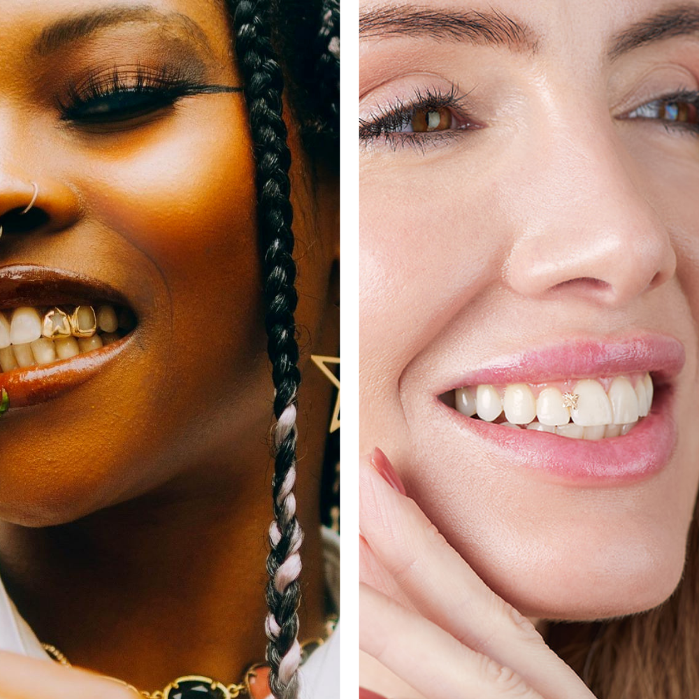 Smile Jewellery vs. Traditional Tooth Jewelry – Which Would You Choose?